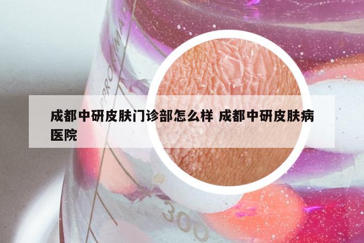 成都中研皮肤门诊部怎么样 成都中研皮肤病医院