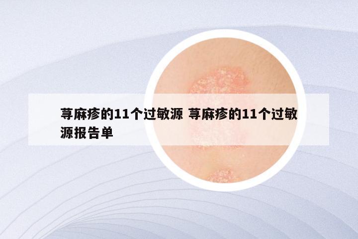 荨麻疹的11个过敏源 荨麻疹的11个过敏源报告单