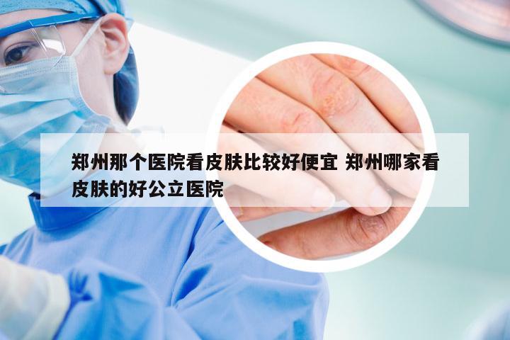 郑州那个医院看皮肤比较好便宜 郑州哪家看皮肤的好公立医院