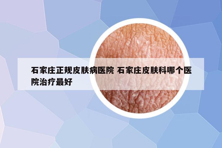 石家庄正规皮肤病医院 石家庄皮肤科哪个医院治疗最好