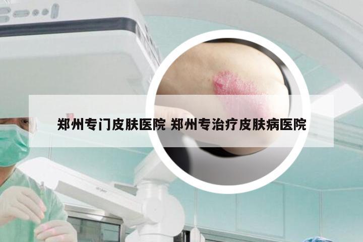 郑州专门皮肤医院 郑州专治疗皮肤病医院