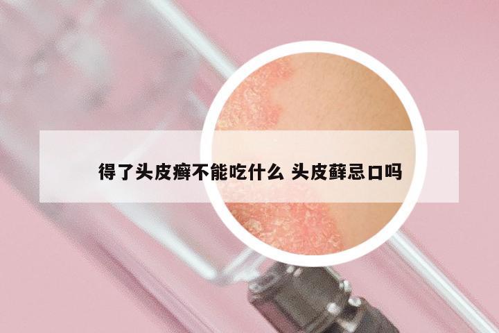 得了头皮癣不能吃什么 头皮藓忌口吗
