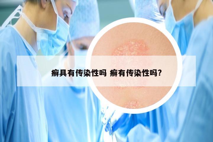 癣具有传染性吗 癣有传染性吗?