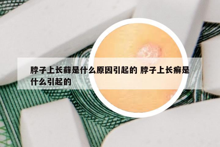 脖子上长藓是什么原因引起的 脖子上长癣是什么引起的