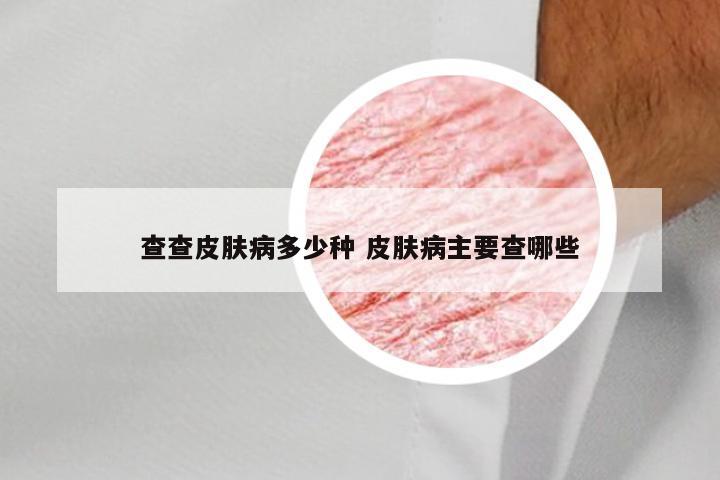 查查皮肤病多少种 皮肤病主要查哪些