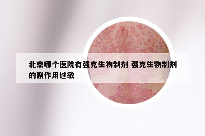 北京哪个医院有强克生物制剂 强克生物制剂的副作用过敏