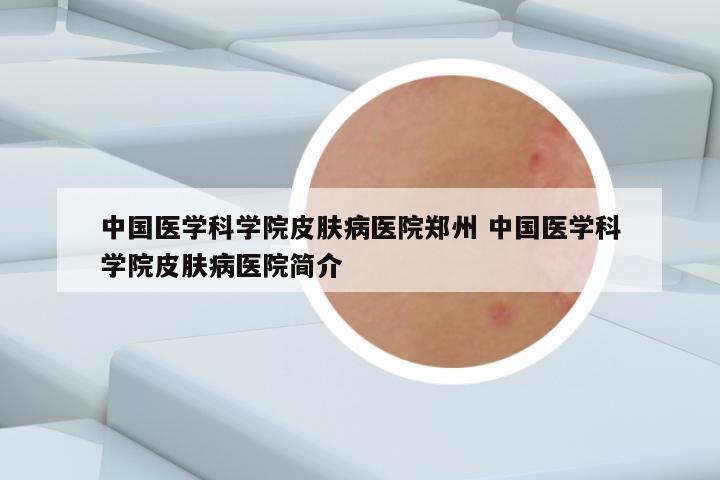 中国医学科学院皮肤病医院郑州 中国医学科学院皮肤病医院简介