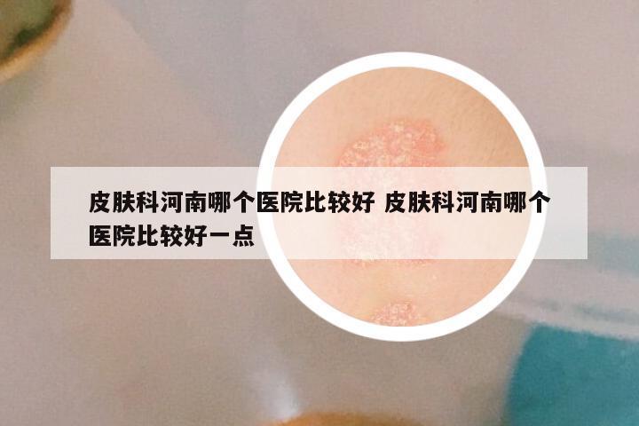 皮肤科河南哪个医院比较好 皮肤科河南哪个医院比较好一点