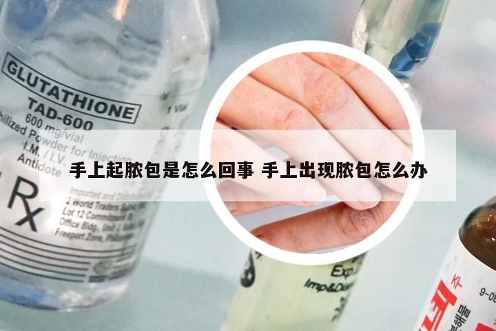 手上起脓包是怎么回事 手上出现脓包怎么办
