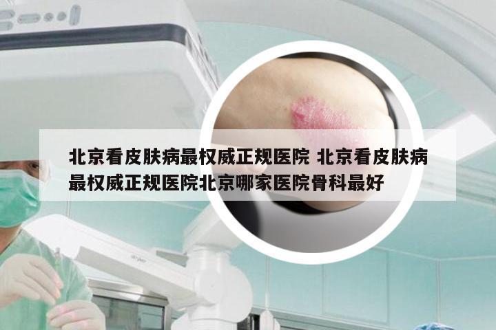 北京看皮肤病最权威正规医院 北京看皮肤病最权威正规医院北京哪家医院骨科最好