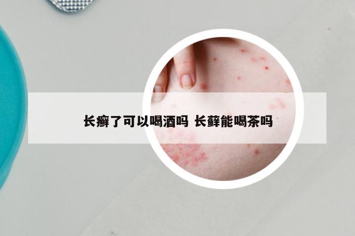 长癣了可以喝酒吗 长藓能喝茶吗