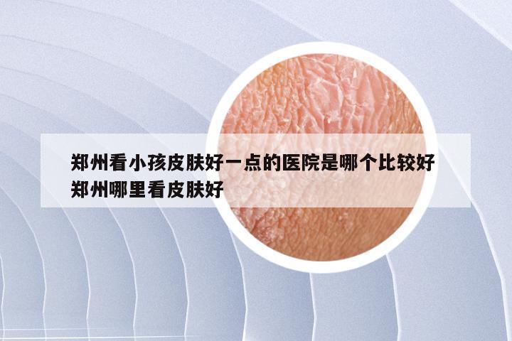 郑州看小孩皮肤好一点的医院是哪个比较好 郑州哪里看皮肤好