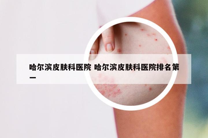 哈尔滨皮肤科医院 哈尔滨皮肤科医院排名第一