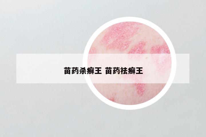 苗药杀癣王 苗药祛癣王