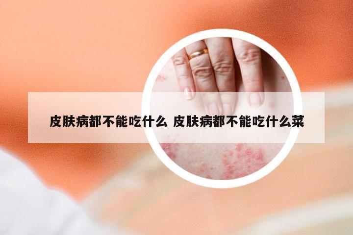 皮肤病都不能吃什么 皮肤病都不能吃什么菜
