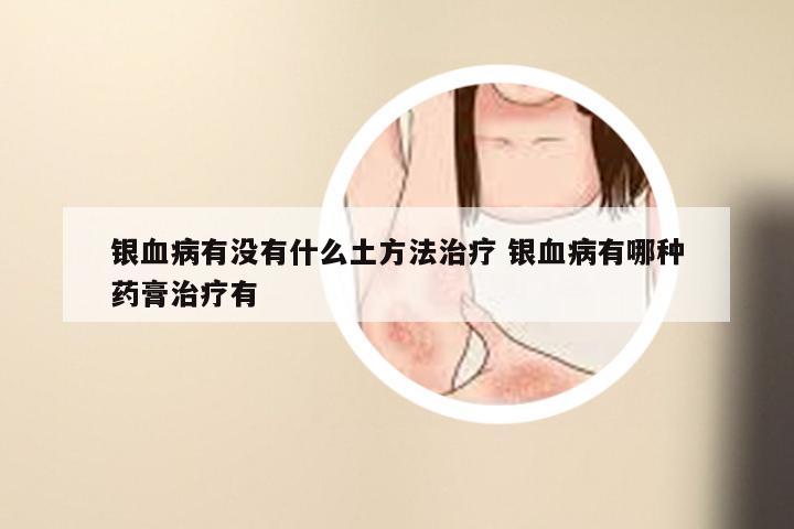 银血病有没有什么土方法治疗 银血病有哪种药膏治疗有