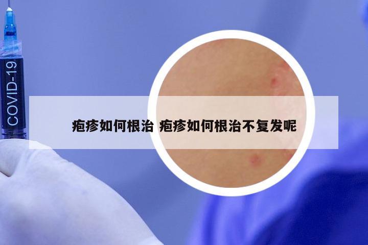 疱疹如何根治 疱疹如何根治不复发呢