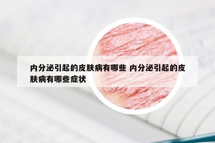 内分泌引起的皮肤病有哪些 内分泌引起的皮肤病有哪些症状