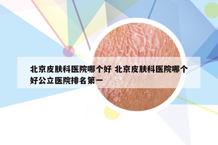北京皮肤科医院哪个好 北京皮肤科医院哪个好公立医院排名第一