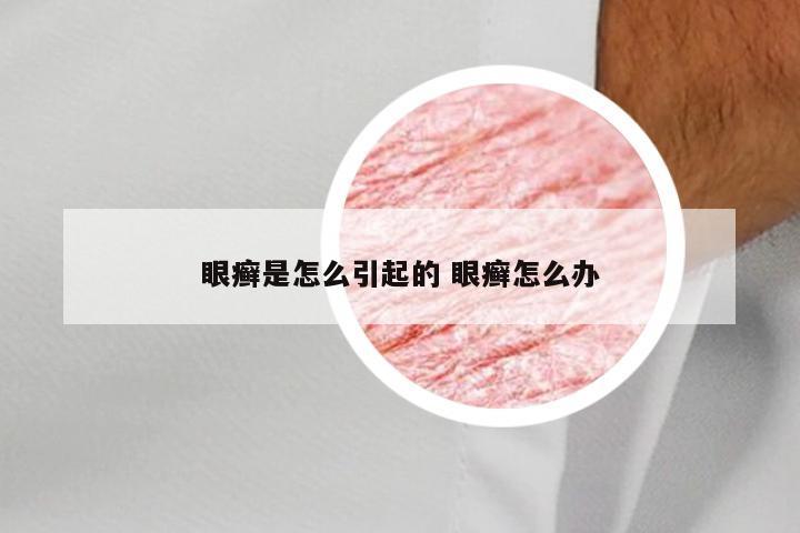 眼癣是怎么引起的 眼癣怎么办