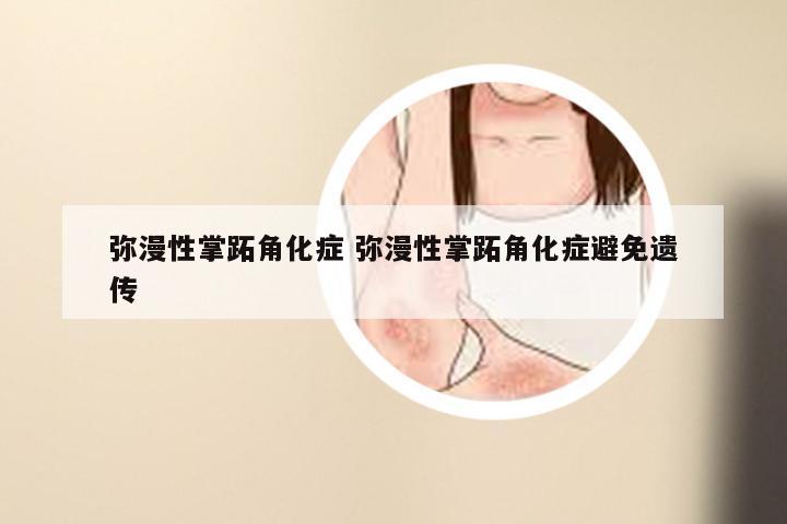 弥漫性掌跖角化症 弥漫性掌跖角化症避免遗传