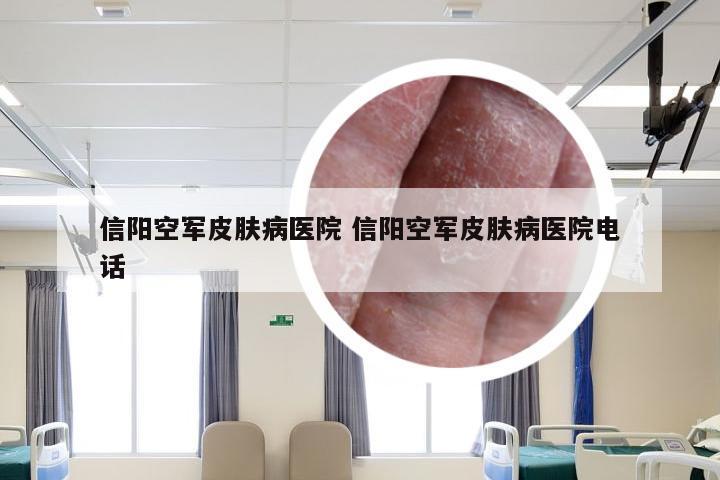 信阳空军皮肤病医院 信阳空军皮肤病医院电话