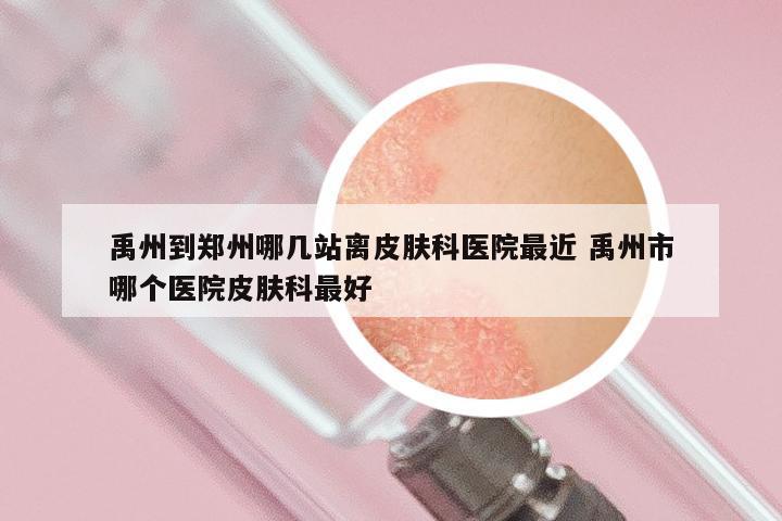 禹州到郑州哪几站离皮肤科医院最近 禹州市哪个医院皮肤科最好