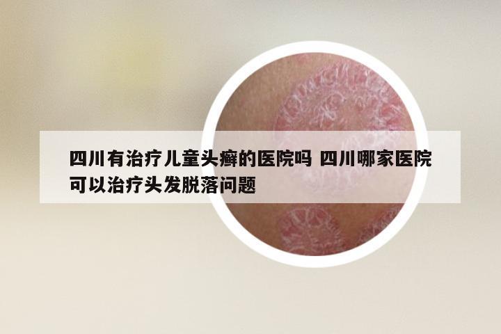四川有治疗儿童头癣的医院吗 四川哪家医院可以治疗头发脱落问题