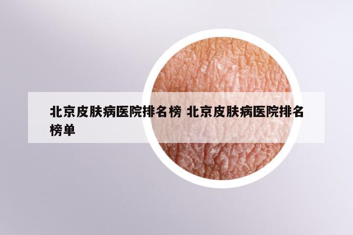 北京皮肤病医院排名榜 北京皮肤病医院排名榜单
