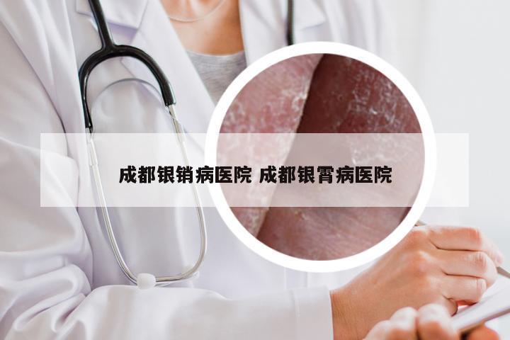 成都银销病医院 成都银霄病医院