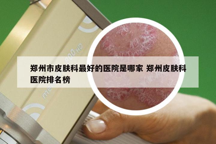 郑州市皮肤科最好的医院是哪家 郑州皮肤科医院排名榜