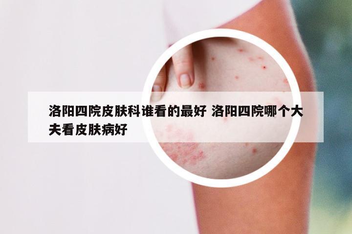 洛阳四院皮肤科谁看的最好 洛阳四院哪个大夫看皮肤病好