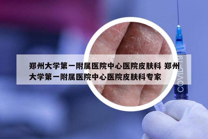 郑州大学第一附属医院中心医院皮肤科 郑州大学第一附属医院中心医院皮肤科专家