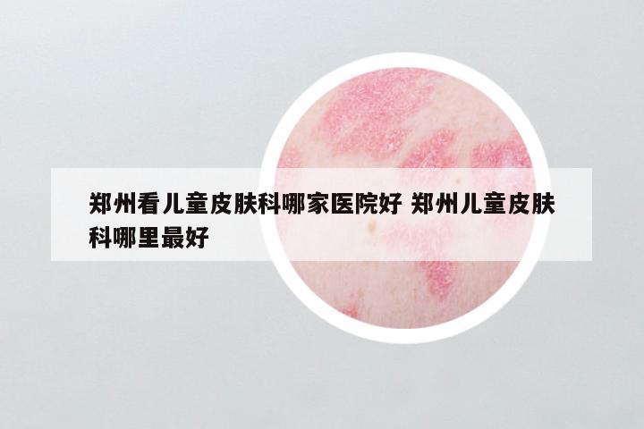 郑州看儿童皮肤科哪家医院好 郑州儿童皮肤科哪里最好