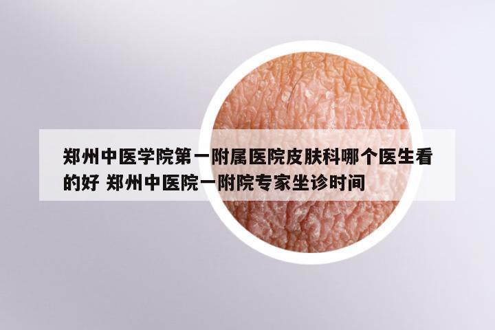 郑州中医学院第一附属医院皮肤科哪个医生看的好 郑州中医院一附院专家坐诊时间
