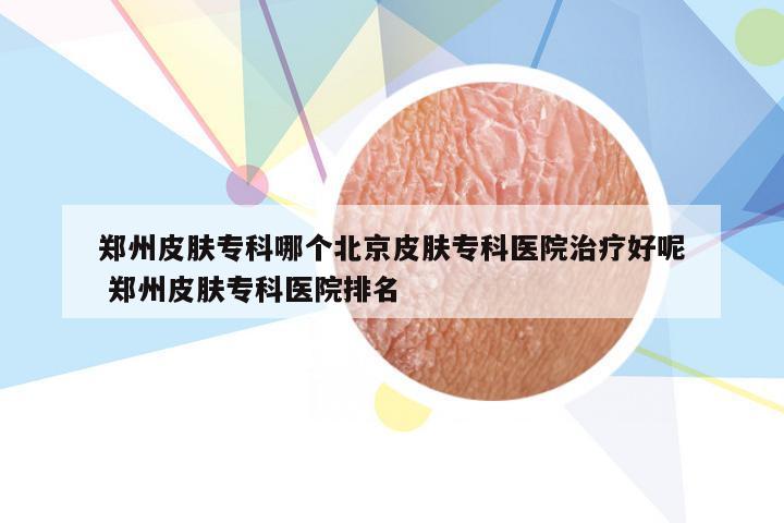 郑州皮肤专科哪个北京皮肤专科医院治疗好呢 郑州皮肤专科医院排名