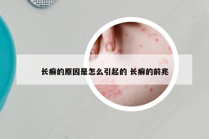 长癣的原因是怎么引起的 长癣的前兆