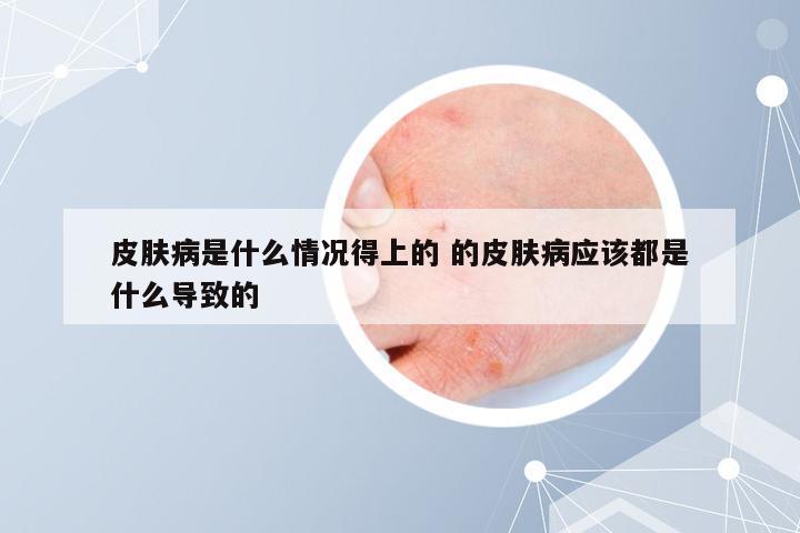 皮肤病是什么情况得上的 的皮肤病应该都是什么导致的