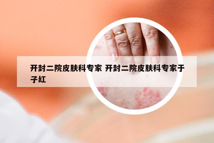 开封二院皮肤科专家 开封二院皮肤科专家于子红