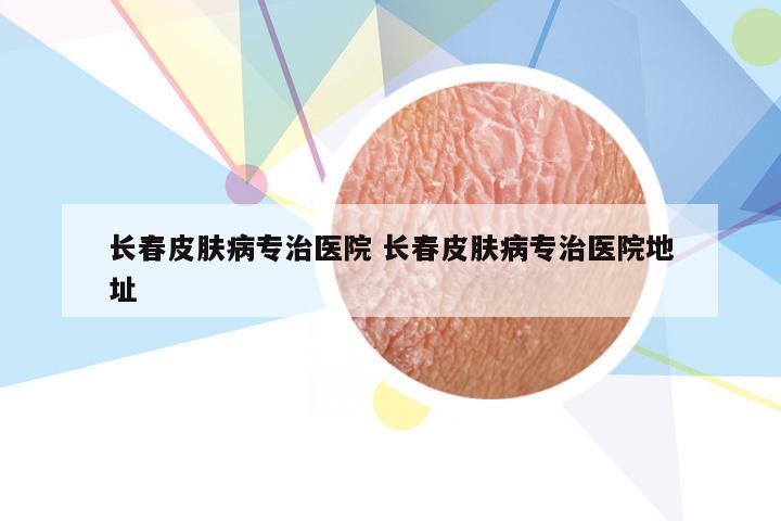 长春皮肤病专治医院 长春皮肤病专治医院地址