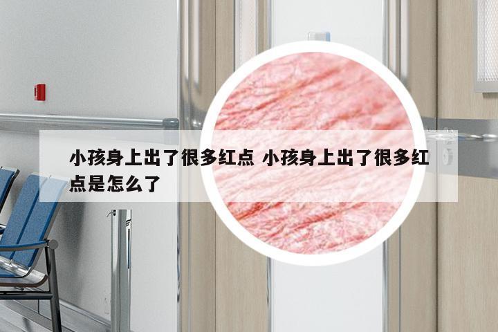 小孩身上出了很多红点 小孩身上出了很多红点是怎么了