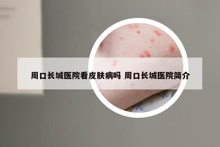 周口长城医院看皮肤病吗 周口长城医院简介