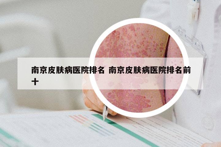 南京皮肤病医院排名 南京皮肤病医院排名前十