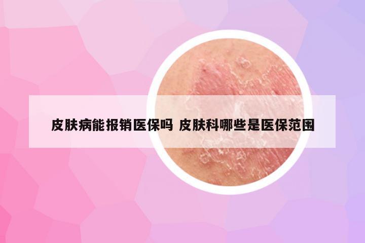 皮肤病能报销医保吗 皮肤科哪些是医保范围