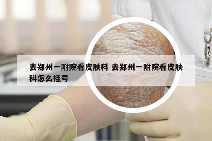 去郑州一附院看皮肤科 去郑州一附院看皮肤科怎么挂号