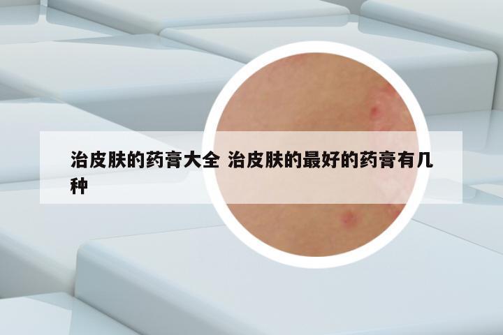 治皮肤的药膏大全 治皮肤的最好的药膏有几种