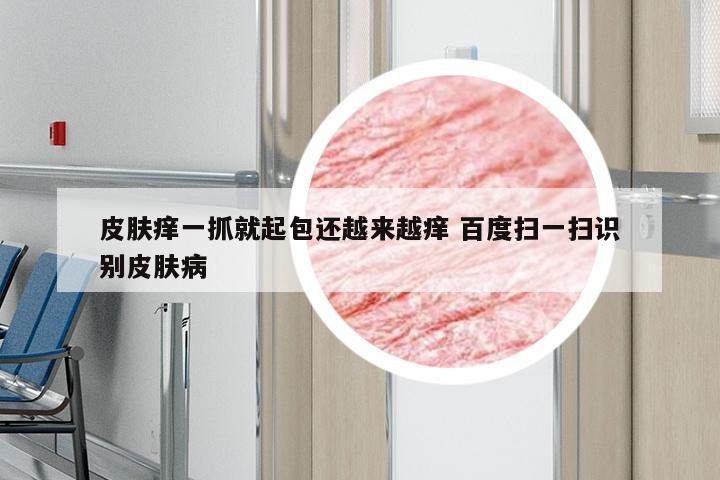 皮肤痒一抓就起包还越来越痒 百度扫一扫识别皮肤病