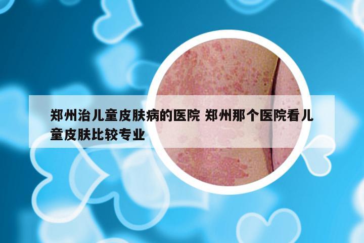 郑州治儿童皮肤病的医院 郑州那个医院看儿童皮肤比较专业
