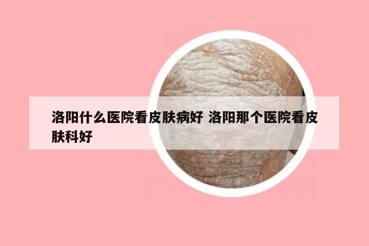 洛阳什么医院看皮肤病好 洛阳那个医院看皮肤科好