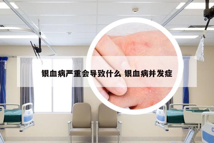 银血病严重会导致什么 银血病并发症